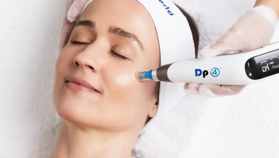 Appareil de microneedling lors d'une procédure de soin de la peau