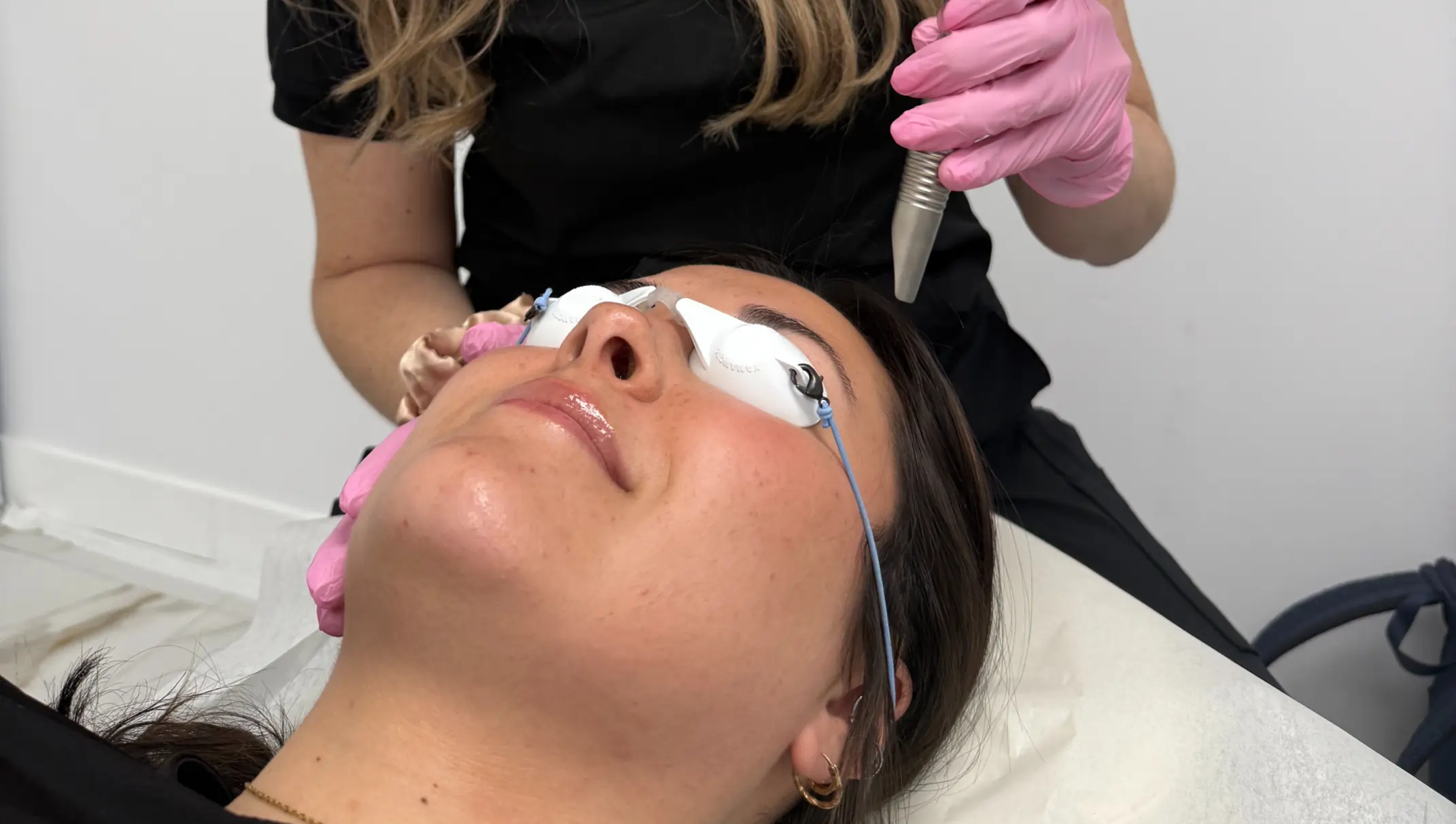 Facelift laser non invasif Fotona 4D pour raffermir la peau