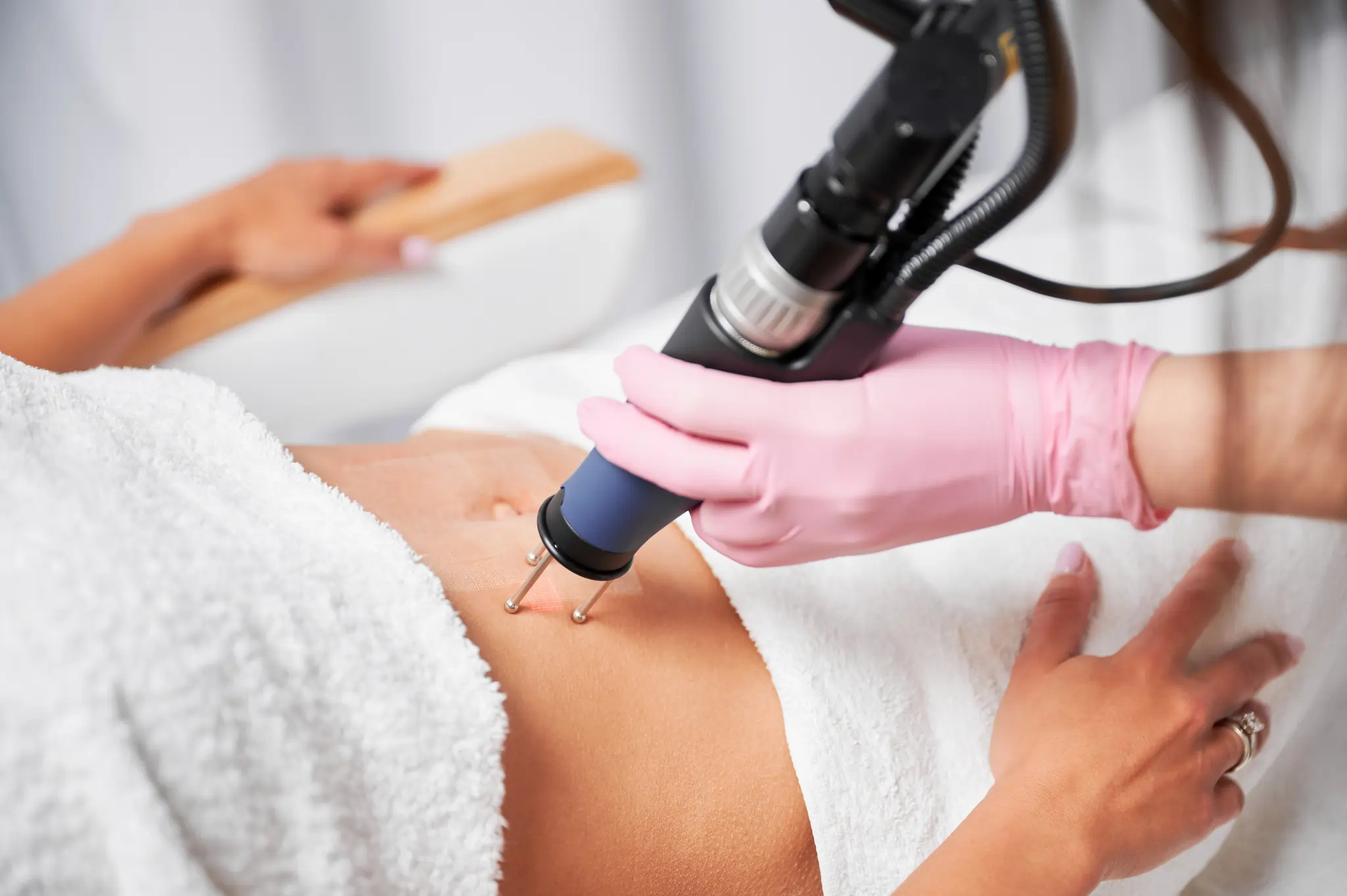 Traitement laser corporel TightSculpting et lipolyse pour raffermir la silhouette